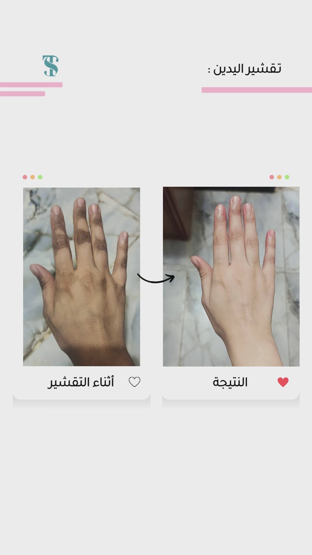 تحميل الفيديو: 